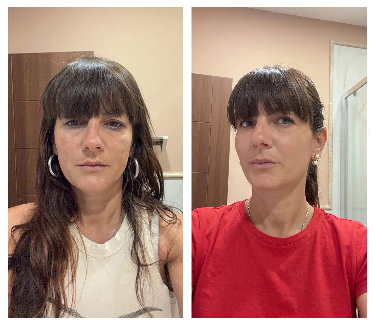 Нина Д. преди и след FlexRenew Forte